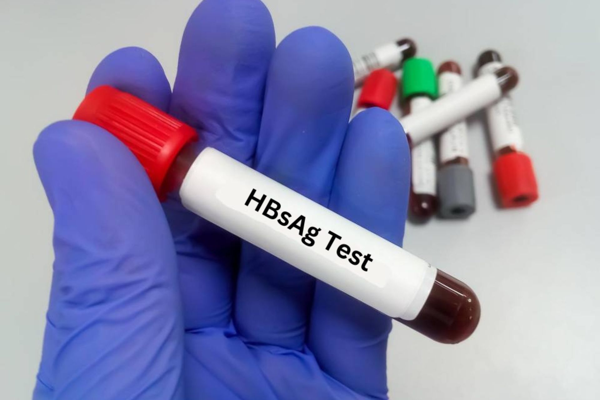 Hbsag test price in Bangladesh